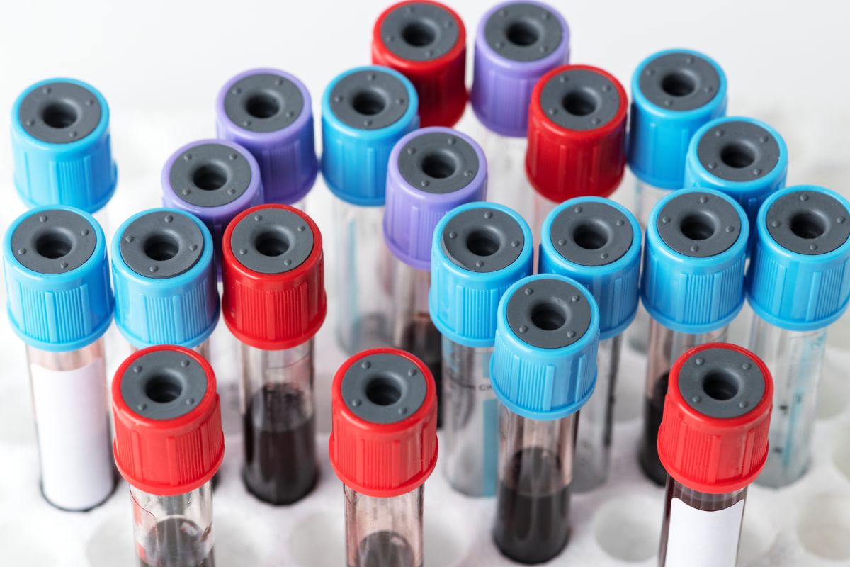 Arterial Blood Gas