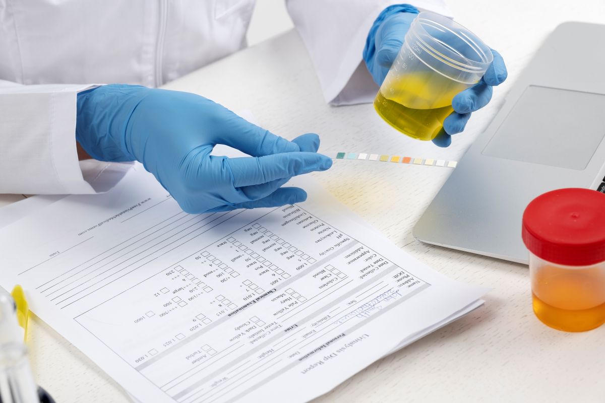 Urine Test